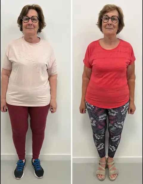 2 instantanés d’une même membre du club Centre Nutri-Form, pris de face, l’un avant et l’autre après